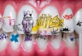 /album/nadherne-umeni/paint-on-teeth-jpg/